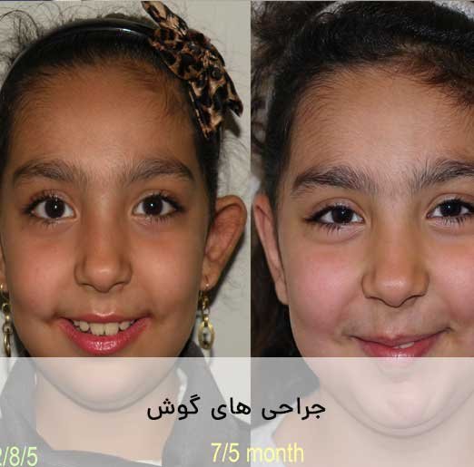 نمونه جراحی گوش
